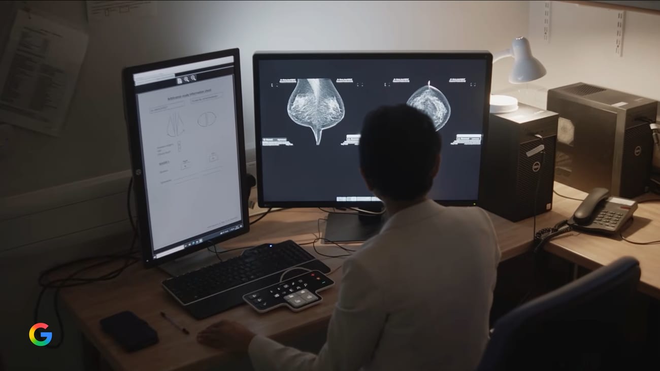 Gambar dari Google Blog untuk berita: Google Gunakan AI untuk Percepat Penelitian Medis dan Deteksi Penyakit